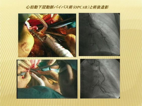 金沢医療センター 心臓血管外科 心臓外科